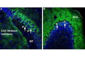 Expression of Na+/K+ ATPase α2 (ATP1A2) in mouse hippocampus and cerebellum - Immunohistochemical staining of perfusion-fixed frozen rat brain sections using Anti-Alpha 2 Na+/K+ ATPase Antibody (ABIN7042961, ABIN7044639 and ABIN7044640), (1:300), followed by goat-anti-rabbit-AlexaFluor-488 secondary antibody. (ATP1A2 antibody  (Intracellular, N-Term))