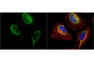 ICC/IF Image PDI antibody [N1N3] detects PDI protein at endoplasmic reticulum by immunofluorescent analysis. (P4HB antibody)