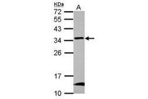 Image no. 1 for anti-Glioblastoma Amplified Sequence (GBAS) (AA 77-265) antibody (ABIN1498393) (GBAS antibody  (AA 77-265))
