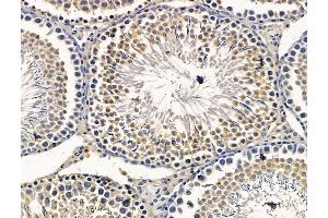 ABIN7096401 and ABIN7100465 at 1/100 staining rat testis tissue by IHC-P. (SPEF1 antibody)