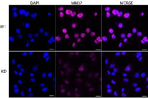 Immunocytochemical staining of HT- cells using MBD2 antibody (ABIN7799386), 1:1,000), Top panel: wild-type (WT), Bottom panal: MBD2 shRNA knockdown (KD). (Recombinant MBD2 antibody)
