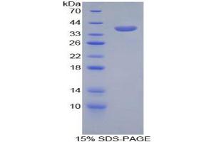 SDS-PAGE analysis of Mouse CPB1 Protein. (CPB1 Protein)