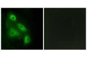 Immunofluorescence analysis of HeLa cells, using ES8L3 antibody. (EPS8-Like 3 antibody)