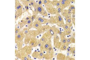 Immunohistochemistry of paraffin-embedded human liver injury using KIF1B Antibody. (KIF1B antibody  (AA 1501-1770))