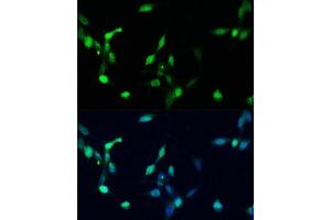 Immunofluorescence analysis of NIH/3T3 cells using p27 KIP 1 antibody (ABIN3020889, ABIN3020890, ABIN3020891 and ABIN6213779) at dilution of 1:100. (CDKN1B antibody  (AA 1-198))