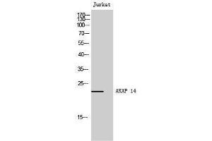 Western Blotting (WB) image for anti-A Kinase (PRKA) Anchor Protein 14 (AKAP14) (N-Term) antibody (ABIN3173725) (AKAP14 antibody  (N-Term))