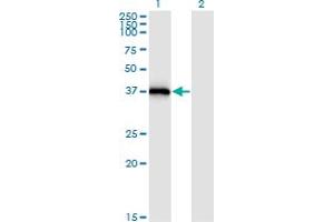 Western Blot analysis of STX16 expression in transfected 293T cell line by STX16 monoclonal antibody (M03), clone 3D12.