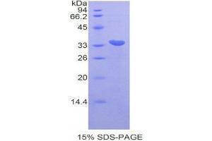 SDS-PAGE (SDS) image for Cyclin-Dependent Kinase 7 (CDK7) (AA 12-295) protein (His tag) (ABIN1878428) (CDK7 Protein (AA 12-295) (His tag))