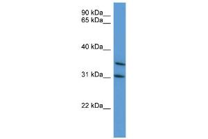 WB Suggested Anti-MAPKAPK3 Antibody Titration: 0.