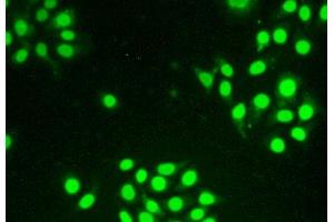 Figure:FITC staining on IHC-P Simple: Hela cells (Thymopoietin antibody  (AA 1-243))