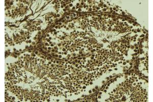 ABIN6273707 at 1/100 staining Mouse testis tissue by IHC-P. (SYCP1 antibody  (C-Term))