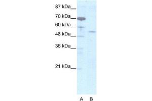 WB Suggested Anti-EVX2 Antibody Titration:  2.