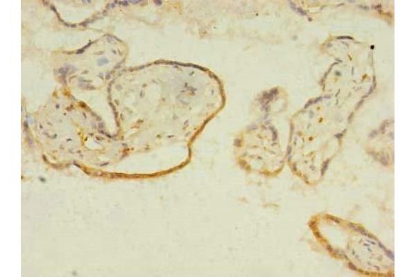 ITIH5 antibody  (AA 35-161)