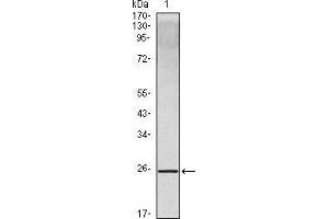 Western blot analysis using IL10 mouse mAb against IL10 recombinant protein. (IL-10 antibody)