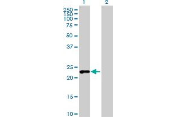G Substrate antibody  (AA 1-155)