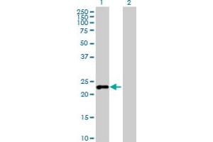Western Blot analysis of C7orf16 expression in transfected 293T cell line by C7orf16 MaxPab polyclonal antibody. (G Substrate antibody  (AA 1-155))