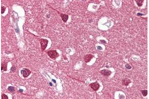 Human Brain, Cortex (formalin-fixed, paraffin-embedded) stained with REXO1 antibody ABIN364336 at 5 ug/ml followed by biotinylated anti-mouse IgG secondary antibody ABIN481714, alkaline phosphatase-streptavidin and chromogen. (REXO1 antibody  (AA 1060-1221))