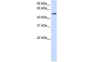 USP22 antibody used at 1 ug/ml to detect target protein. (USP22 antibody  (Middle Region))