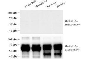 Western blot analysis of phospho-TAU (S202/T205) (ABIN7075838) at dilution of 1: 1000 The figure above was treated with phospho-blocking pepide, the figure below was treated with non-phospho- blocking pepide. (tau antibody  (pSer202, pThr205))