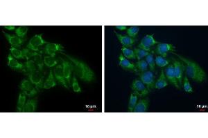 ICC/IF Image TSFM antibody detects TSFM protein at mitochondria by immunofluorescent analysis.