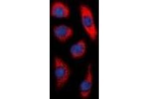 Immunofluorescent analysis of DCP1A staining in HepG2 cells. (DCP1A antibody)