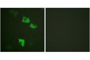 Immunofluorescence analysis of HuvEc cells, using eEF2 (Ab-56) Antibody. (EEF2 antibody  (AA 31-80))