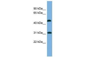 CTDSP2 antibody used at 1 ug/ml to detect target protein.