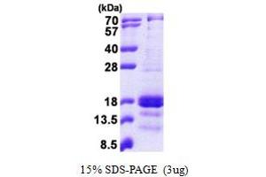 SDS-PAGE (SDS) image for gamma-Interferon-Induced Monokine (CXCL9) (AA 23-125) protein (His tag) (ABIN5853039) (CXCL9 Protein (AA 23-125) (His tag))