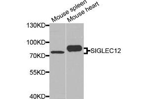 Western blot analysis of extracts of various cell lines, using SIGLEC12 antibody. (SIGLEC12 antibody)