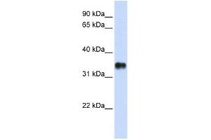 KCTD7 antibody used at 1 ug/ml to detect target protein. (KCTD7 antibody  (N-Term))