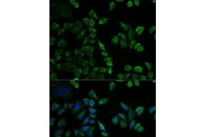 Immunofluorescence analysis of U2OS cells using MSLN Polyclonal Antibody (Mesothelin antibody)