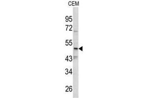 Western blot analysis of SMYD3 antibody (N-term) in CEM cell line lysates (35ug/lane). (SMYD3 antibody  (N-Term))