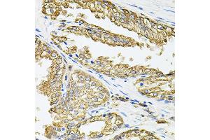 Immunohistochemistry of paraffin-embedded human prostate using HLA-DQA1 antibody (ABIN1873029) at dilution of 1:100 (40x lens).
