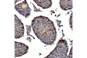 IHC analysis of TTLL2 using anti-TTLL2 antibody (ABIN7600850). (TTLL2 antibody  (AA 24-582))