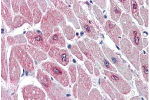 Human Heart (formalin-fixed, paraffin-embedded) stained with PARD6A antibody ABIN337017 at 5 ug/ml followed by biotinylated anti-goat IgG secondary antibody ABIN481715, alkaline phosphatase-streptavidin and chromogen. (PARD6A antibody  (AA 334-346))