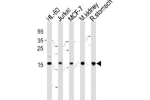 NME2 Antibody (F40) (ABIN392656 and ABIN2842157) western blot analysis in HL-60,Jurkat,MCF-7 cell line,mouse kidney and rat stomach tissue lysates (35 μg/lane). (NME2 antibody  (N-Term))