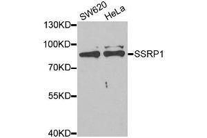 Western blot analysis of extracts of SW620 and HeLa cell lines, using SSRP1 antibody. (SSRP1 antibody)