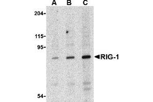 Western Blotting (WB) image for anti-DEAD (Asp-Glu-Ala-Asp) Box Polypeptide 58 (DDX58) antibody (ABIN1031791) (DDX58 antibody)