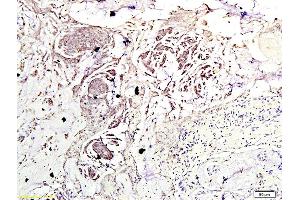 Formalin-fixed and paraffin embedded mouse kidney labeled with Anti-Phospho-FRAP1/mTOR(Ser2448) Polyclonal Antibody, Unconjugated (ABIN747158) at 1:200 followed by conjugation to the secondary antibody and DAB stainin (MTOR antibody  (pSer2448))