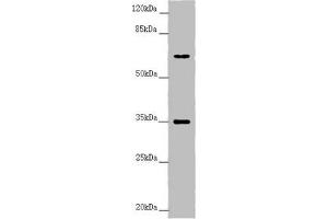 Western blot All lanes: TRIM23 antibody at 4. (TRIM23 antibody  (AA 1-280))