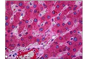 Human Liver: Formalin-Fixed, Paraffin-Embedded (FFPE). (C3 antibody)