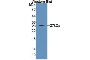 Figure. (ABCA8 antibody  (AA 1305-1516))