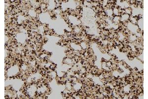 ABIN6277586 at 1/100 staining Rat lung tissue by IHC-P. (TPT1 antibody  (Internal Region))