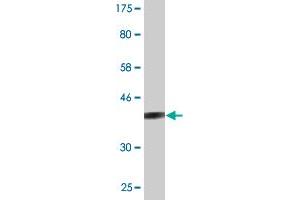 Western Blot detection against Immunogen (37. (STAT6 antibody  (AA 694-801))