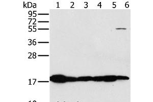 Western Blot analysis of Mouse heart and muscle tissue, hela cell and Mouse liver tissue, Mouse kidney tissue and hepg2 cell using MTFP1 Polyclonal Antibody at dilution of 1:450 (Mtfp1 antibody)