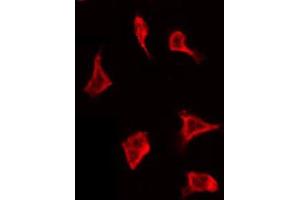 ABIN6267692 staining 293 by IF/ICC. (WNK1 antibody  (pThr60))