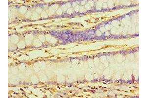 Immunohistochemistry of paraffin-embedded human colon tissue using ABIN7166903 at dilution of 1:100 (PDHX antibody  (AA 1-300))
