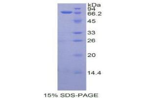 SDS-PAGE (SDS) image for Albumin (ALB) (AA 25-609) protein (His tag) (ABIN2120495)