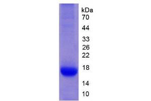 Image no. 1 for Interleukin 32 (IL32) (AA 1-188) protein (His tag) (ABIN1878791) (IL32 Protein (AA 1-188) (His tag))