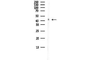 anti-serpin Peptidase Inhibitor, Clade B (Ovalbumin), Member 5 (SERPINB5) (Internal Region) antibody